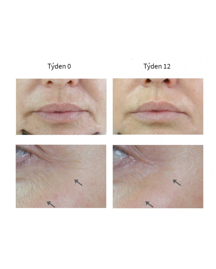 Medik8 R-Retinoate Day & Night Sérum s patentovanou molekulou vitamínu A 50 ml