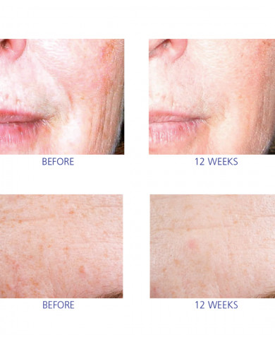 Active Serum Active Serum