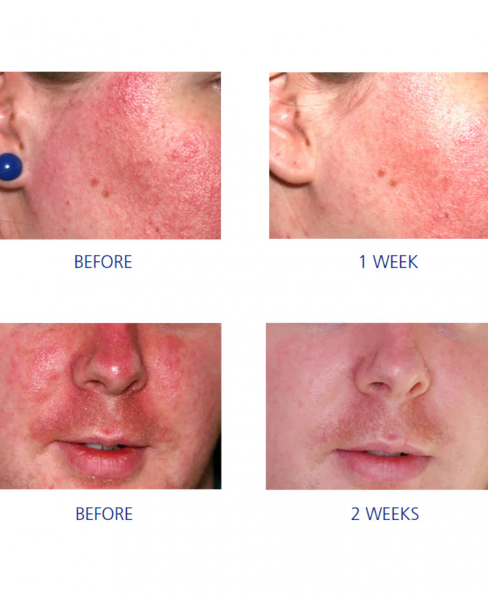 Sérum Pro-Híl Edvans+ Pro-Heal Serum Advance+ 15 ml