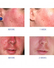 Sérum Pro-Híl Edvans+ Pro-Heal Serum Advance+ 15 ml