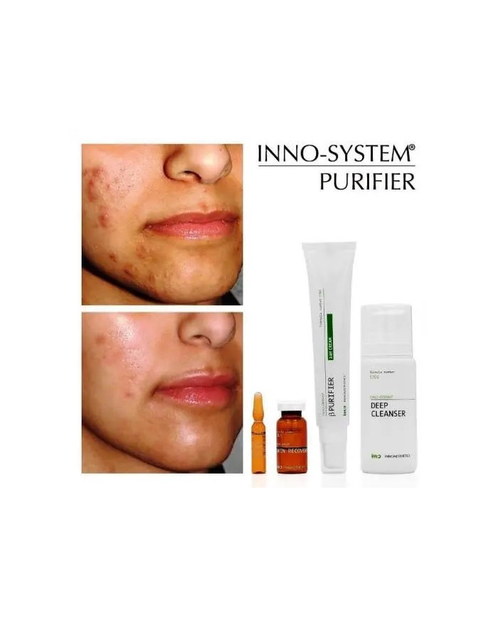 INNO-DERMA Purifier Night Gel – noční krém pro mastnou a aknózní pleť