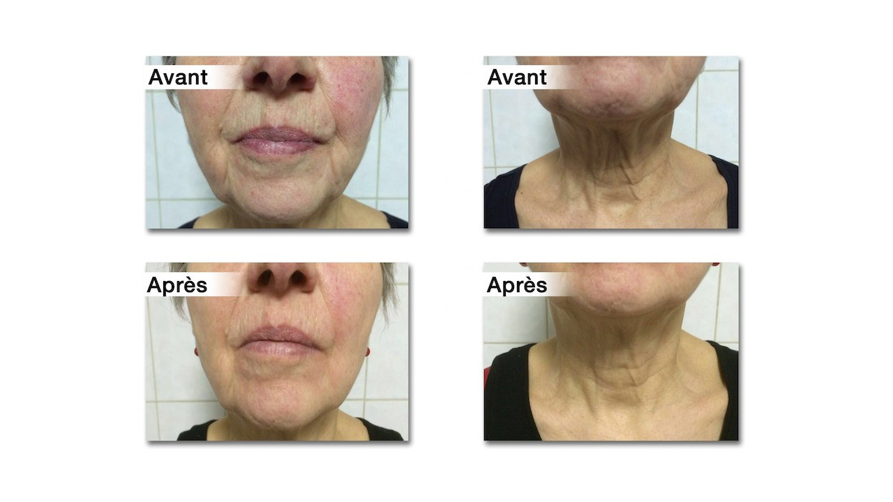 Vědecké důkazy a výsledky Collagen Lift Paris